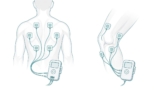 TENS 7000 Pad Placement Guide